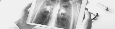 Lungs on Fire